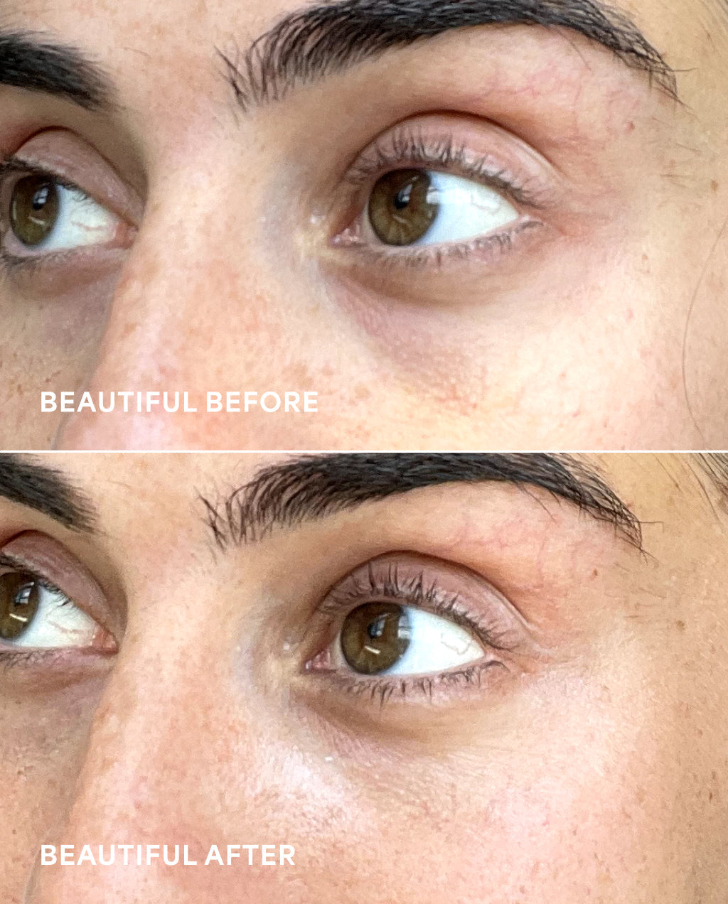 Glow + Get It | Cooling & Brightening Eye Balm